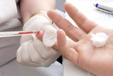 Brze pretrage krvi uključivo i CRP u liječničkim ordinacijama