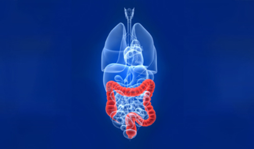 Rak debelog crijeva - etiologija i klinička slika