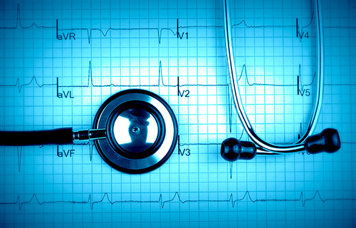 Što treba znati o novom AHA kalkulatoru rizika od kardiovaskularnih bolesti