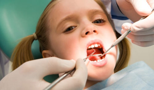 Fluor je učinkovit za karijes dječjih trajnih zubi