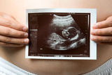 Ishodi trudnoća kod primjene glatiramer acetata tijekom sva tri trimestra   