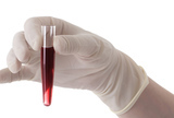 Tribina: Prevencija i liječenje anemije u gerijatriji