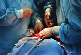 Ispiranje rana za sprječavanje infekcija kirurške rane