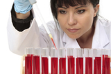Krvni test predviđa širenje melanoma