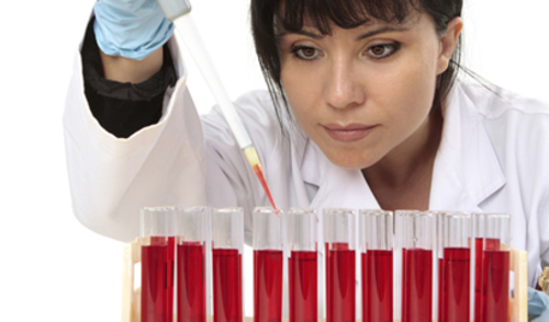 Troponin T test može detektirati dugoročan kardiovaskularni rizik Troponin T test može detektirati dugoročan kardiovaskularni rizik
