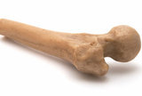 Patofiziologija i liječenje osteoporoze