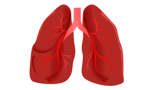 Promjene plućnog intersticija utječu na sveukupnu smrtnost