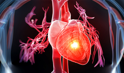 Odgođeno postavljanje dijagnoze kritičnih prirođenih srčanih grešaka