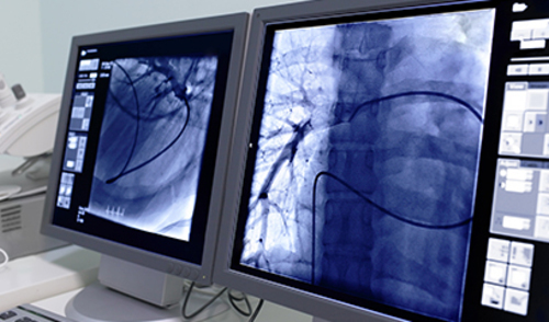 Djelatnici kardioloških laboratorija su pod povećanim zdravstvenim rizikom