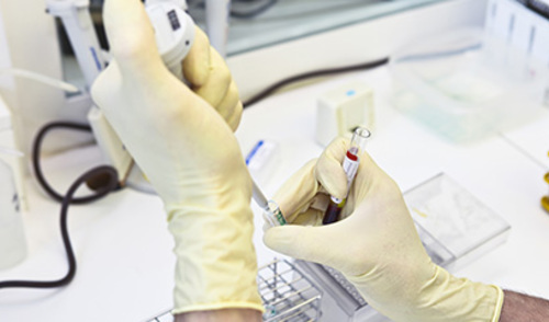 Široka primjena brzih antigenskih testova na terenu na SARS-CoV-2