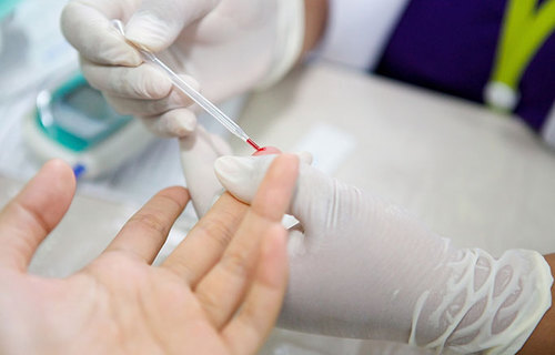 Glikanski biomarkeri mogu identificirati osobe s visokim rizikom za dijabetes Glikanski biomarkeri mogu identificirati osobe s visokim rizikom za dijabetes