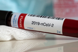 Najrelevantniji test za procjenu imunosti na soj SARS-CoV-2 virusa