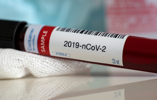 Kamp za djecu i mlade u Gruziji kao izvor epidemije COVID-19 Kamp za djecu i mlade u Gruziji kao izvor epidemije COVID-19