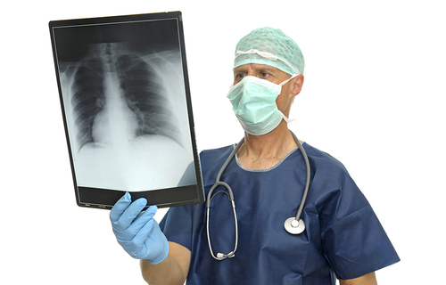 Kronična opstruktivna bolest pluća kod bolesnika s karcinomom pluća 