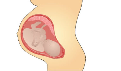 Asimptomatske infekcije kod trudnica u području s visokom prevalencijom COVID-19