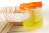 Učinkovitost oralnih antibiotika na Gram-pozitivne uzročnike urinarnih infekcija