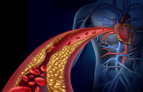 HAZU: Istraživanja reaktivnosti trombocita u različitim srčanožilnim bolestima