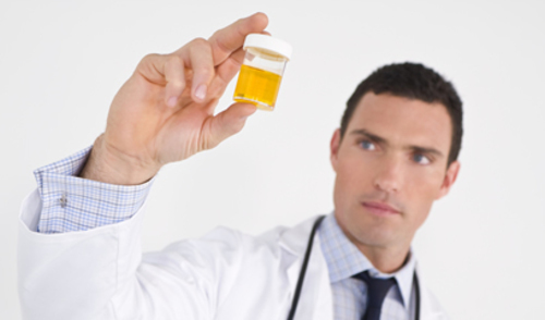Razina PSA u urinu bolesnika s kroničnim prostatitisom