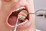Metode procjene dentalne dobi kod odraslih osoba