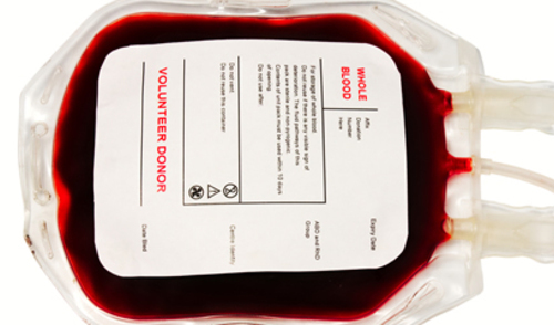 Transfuzijska medicina: jučer, danas, sutra