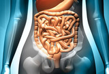 Prikaz bolesnice: Crohnova bolest ili ulcerozni kolitis