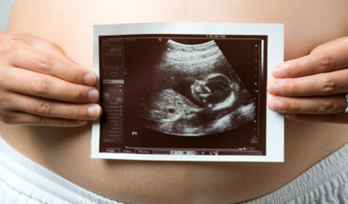 3D vizualizacija i kvantifikacija pokreta fetusa u prvom tromjesečju trudnoće 