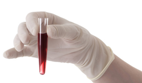 Kada mjeriti troponin T u trijaži pacijenata s plućnom embolijom? Kada mjeriti troponin T u trijaži pacijenata s plućnom embolijom?