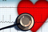 Spužvasta kardiomiopatija- prikaz slučaja