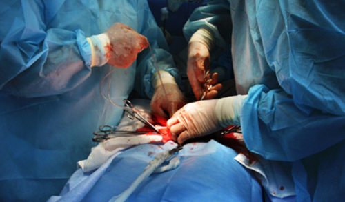 Hrvatska je vodeća zemlja u svijetu u transplantacijskoj medicini 