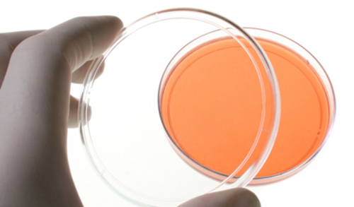 “In vitro in vivo” kliničko značenje rezistencije na antibiotike 