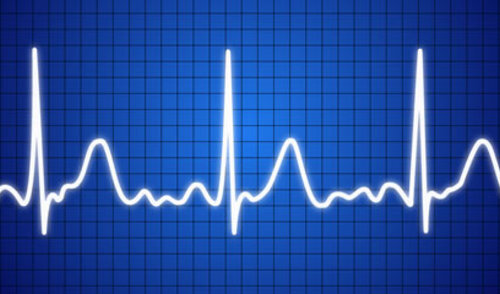 EKG nije dobra metoda probira bolesnika s niskim rizikom za koronarnu bolest
