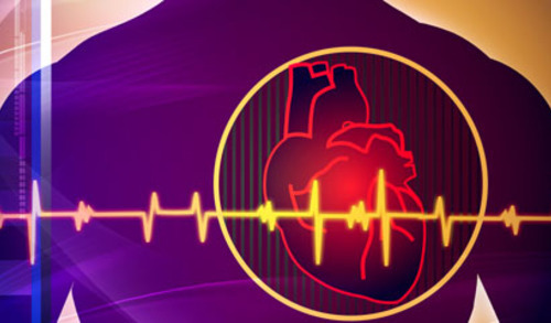 Razina kalcija u koronarnim arterijama prediktor srčanog udara