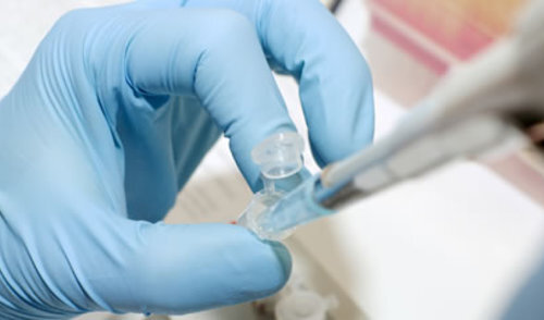 Ponovni osip u liječenoj Lyme boreliozi nastaje zbog reinfekcije  Ponovni osip u liječenoj Lyme boreliozi nastaje zbog reinfekcije