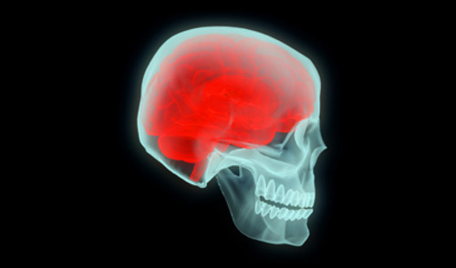 Nove smjernice za zbrinjavanje karotidne i vertebralne bolesti Nove smjernice za zbrinjavanje karotidne i vertebralne bolesti