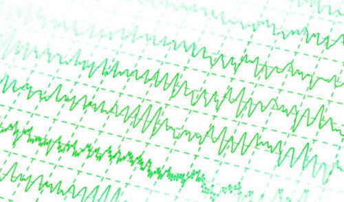 Smjernice za farmakološko liječenje epilepsije
