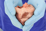 Etika u transplantaciji solidnih organa