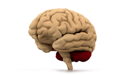 TIA i bodovni sustav u procjeni nastanka moždanog udara