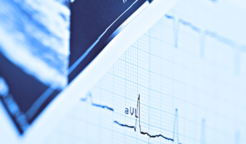 Kronična bubrežna bolest i fibrilacija atrija Kronična bubrežna bolest i fibrilacija atrija