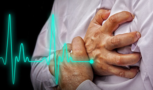 Utječe li PCI na smanjenje simptoma stabilne angine?