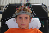 Smjernice za farmakoterapiju epilepsija u djece i adolescenata 