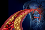 HAZU: Istraživanja reaktivnosti trombocita u različitim srčanožilnim bolestima