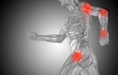 Uloga mikroRNK molekula u patogenezi osteoartritisa Uloga mikroRNK molekula u patogenezi osteoartritisa