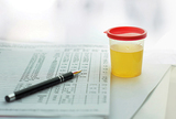 Standardizirani nalaz citološke analize urina