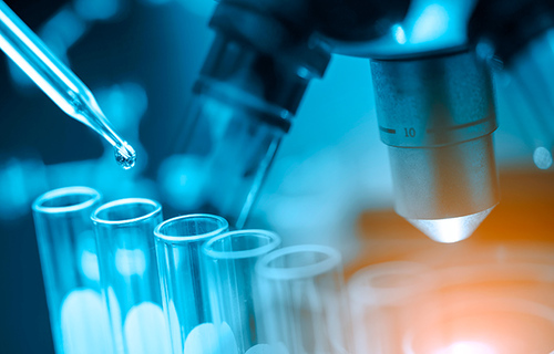  Uvedena metoda PCR-SSP u KBC Split