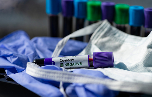 EMA preporučila odobravanje prvog cjepiva protiv COVID-19 