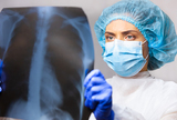 Koinfekcija pluća kod bolesnika s transplantiranim plućima